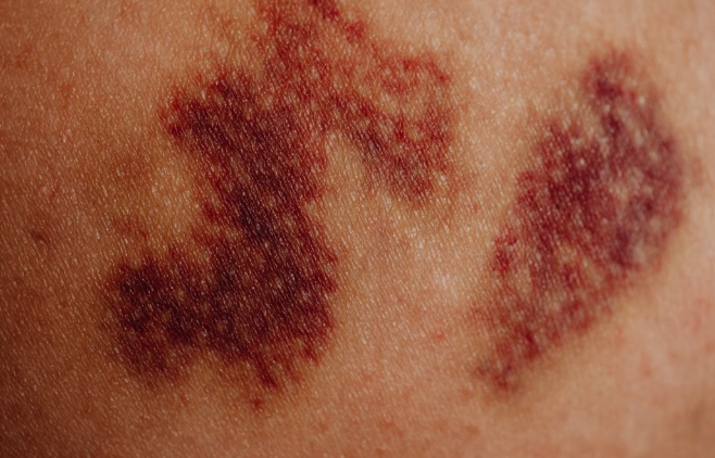 Itching in 9 Areas of the Body: When It May Be a Sign You Should Check With a Doctor